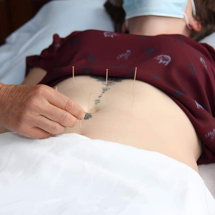 Retrouvez votre équilibre grâce à des soins d’acupuncture personnalisés.