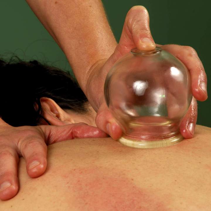 Massage par ventouses pour compléter votre approche thérapeutique.