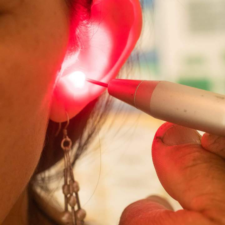 Bénéficiez d’une approche d’acupuncture utilisant la technologie au laser.