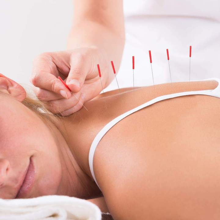 Acupuncture sans rendez-vous pour plus de flexibilité.